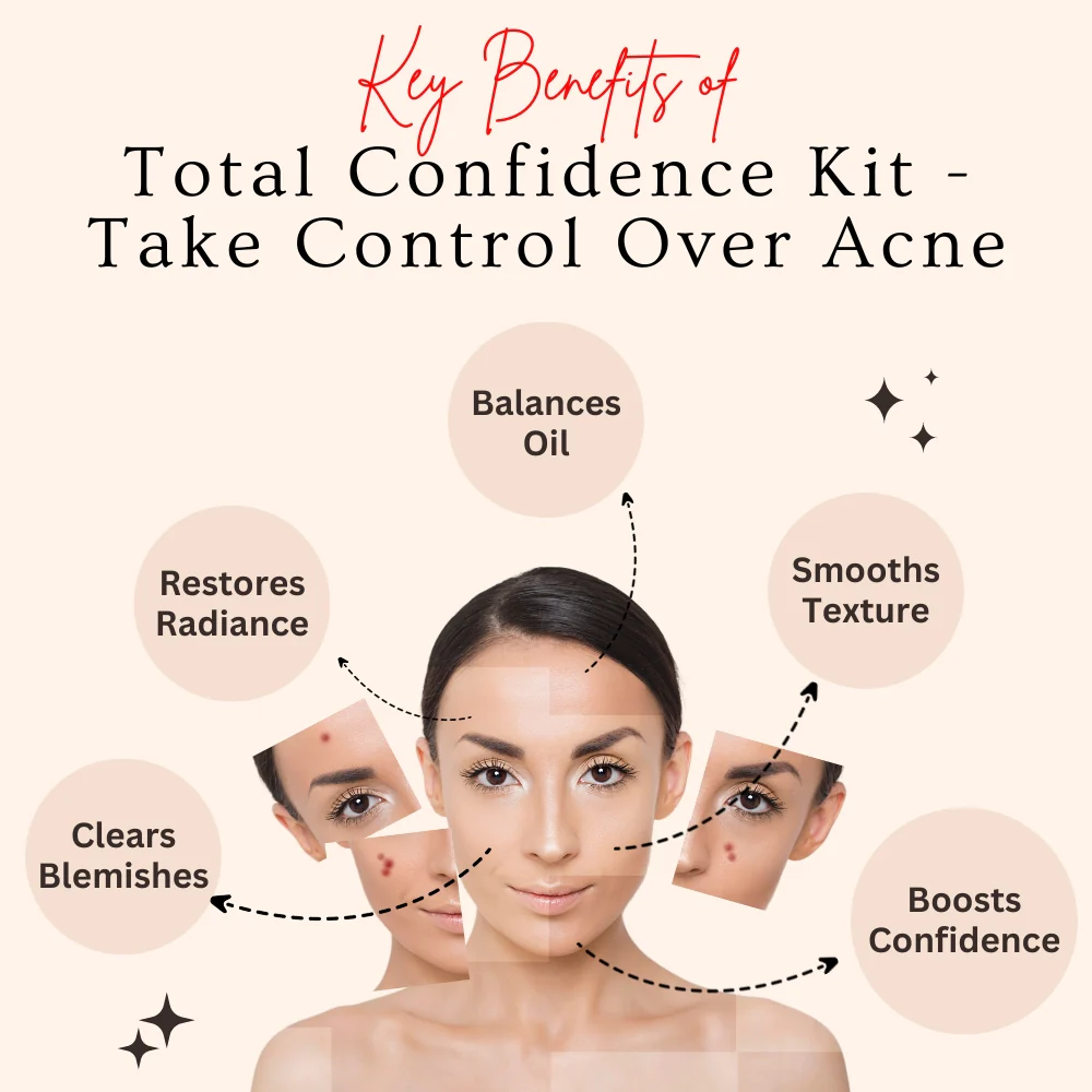 Aroma Treasures Total Confidence Kit - Take Control Over Acne, Acne Home Care Kit (160g/ml)